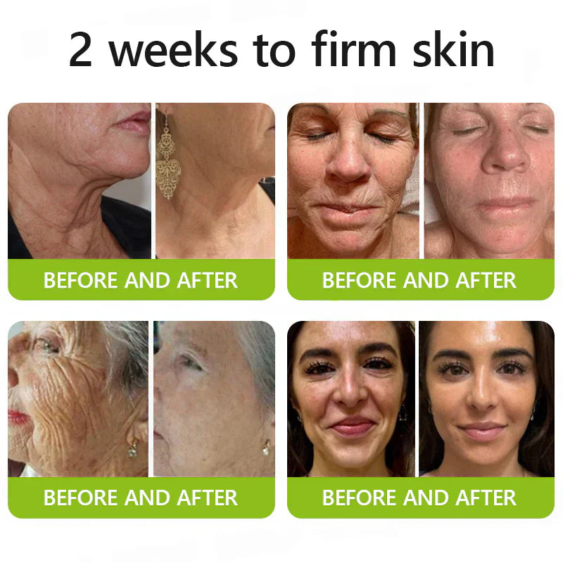 𝑶𝒇𝒇𝒊𝒄𝒊𝒂𝒍 𝑺𝒕𝒐𝒓𝒆👍| Regain youthful skin nown 💫STDEI® BOTOX & VITA A RETINOL SHOT Wrinkle Lift Tightening Cream