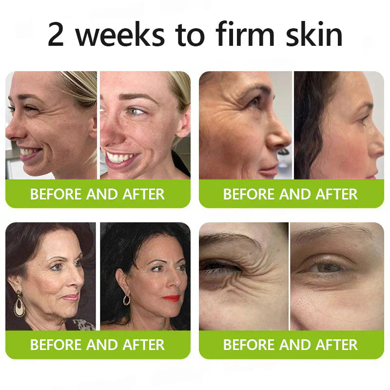 𝑶𝒇𝒇𝒊𝒄𝒊𝒂𝒍 𝑺𝒕𝒐𝒓𝒆👍| Regain youthful skin nown 💫STDEI® BOTOX & VITA A RETINOL SHOT Wrinkle Lift Tightening Cream