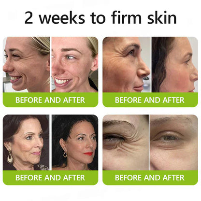𝑶𝒇𝒇𝒊𝒄𝒊𝒂𝒍 𝑺𝒕𝒐𝒓𝒆👍| Regain youthful skin nown 💫STDEI® BOTOX & VITA A RETINOL SHOT Wrinkle Lift Tightening Cream