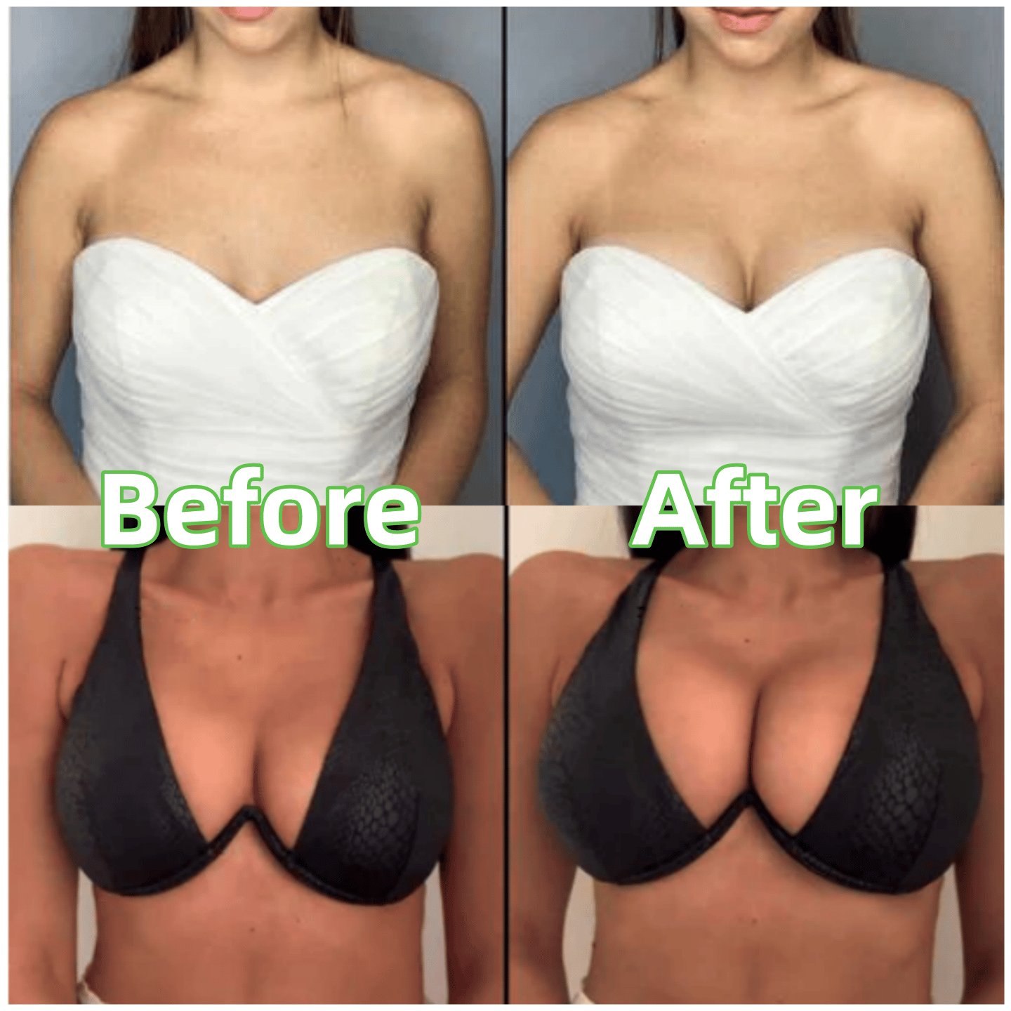💕LAST DAY SALE ONLY $10.99!!💕OUFALI Lift Inserts for Bras – Lightly Padded, Double-Sided Adhesive👙 Reusable, Washable • Natural Lift • Seamless Under Clothing ✨