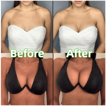 💕LAST DAY SALE ONLY $10.99!!💕OUFALI Lift Inserts for Bras – Lightly Padded, Double-Sided Adhesive👙 Reusable, Washable • Natural Lift • Seamless Under Clothing ✨