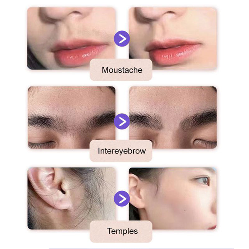 💗Last Day Special Price $9.99 ! 🔥Buy 2 Get 1 Free🔥Gentle and Painless Facial Hair Removal Cream